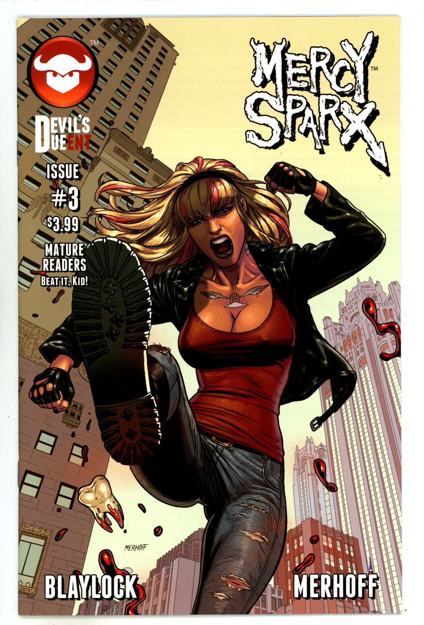Mercy Sparx Vol 2 3  High Grade   (2015)        