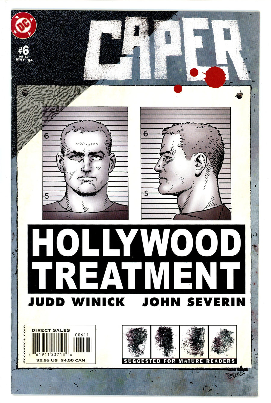 Caper 6