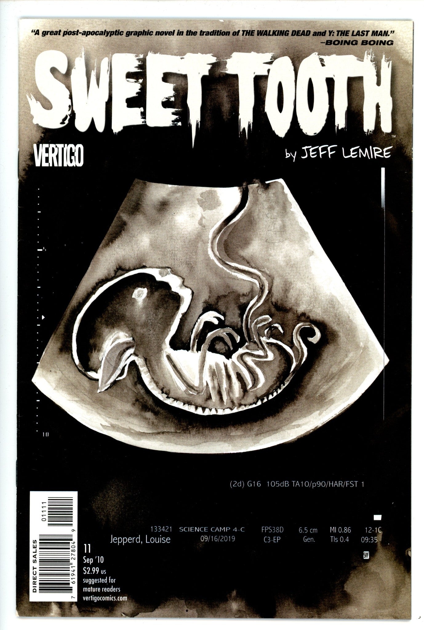 Sweet Tooth 11