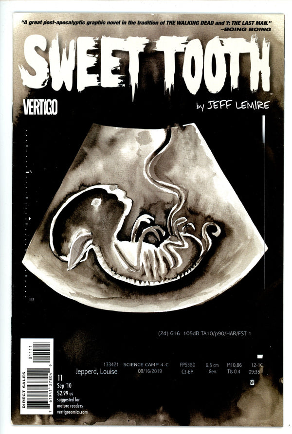 Sweet Tooth 11