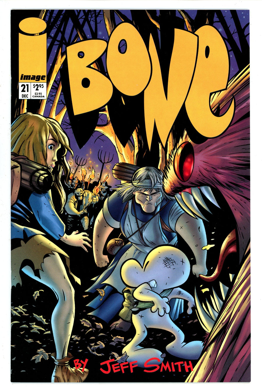 Bone 21